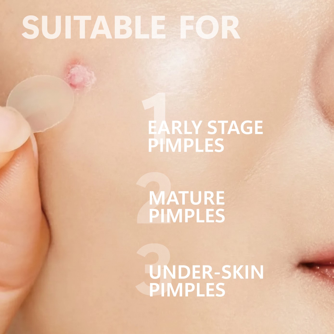 Mikro İğneli Sivilce Bandı (24 - Hydrocolloid Pimple Patch incelemesi ve fiyatı